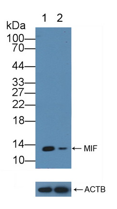 Polyclonal Antibody to Macrophage Migration Inhibitory Factor (MIF)