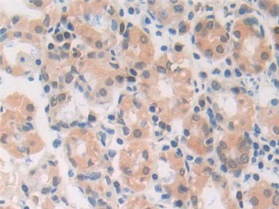 Polyclonal Antibody to Macrophage Migration Inhibitory Factor (MIF)