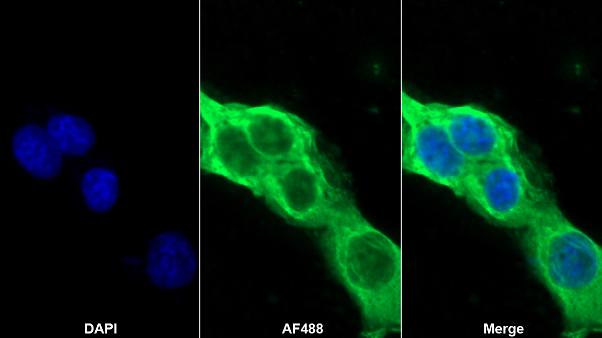 Polyclonal Antibody to Macrophage Migration Inhibitory Factor (MIF)