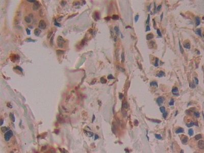 Polyclonal Antibody to Cyclooxygenase-2 (COX 2)