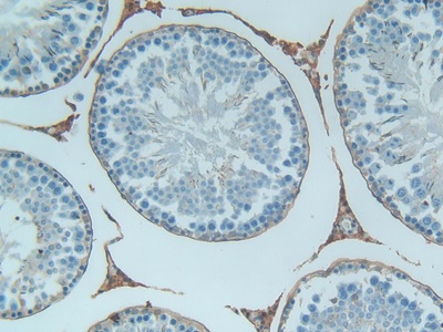 Polyclonal Antibody to Thioredoxin (Trx)