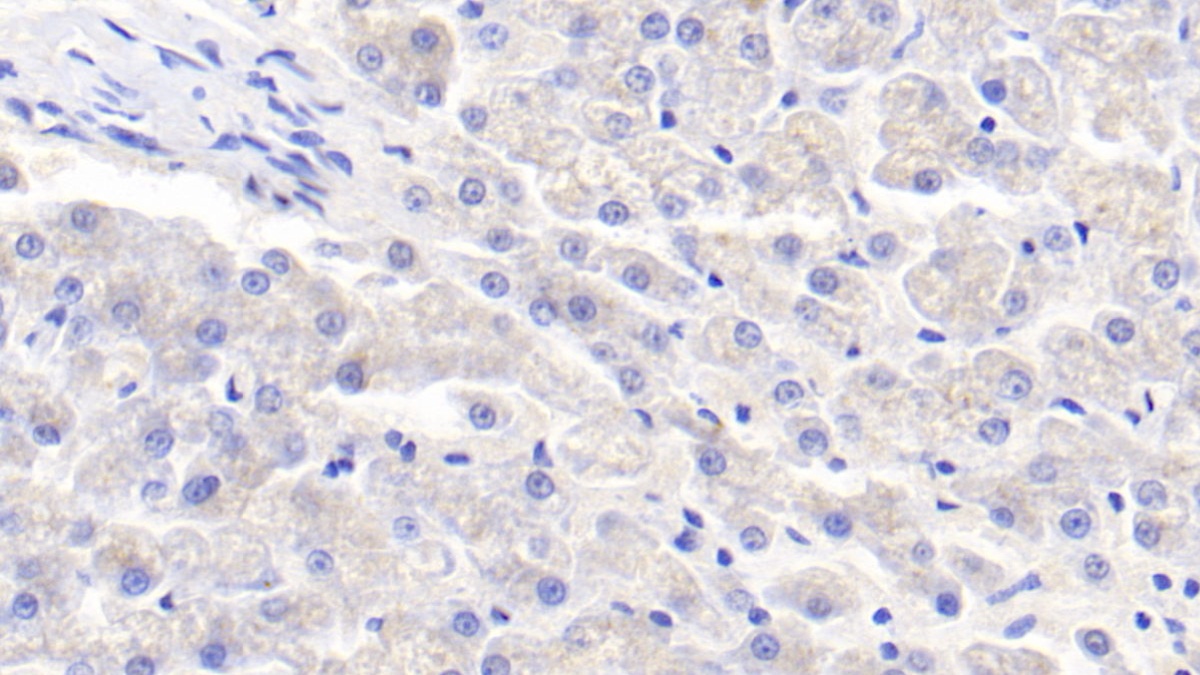 Polyclonal Antibody to Apolipoprotein E (APOE)