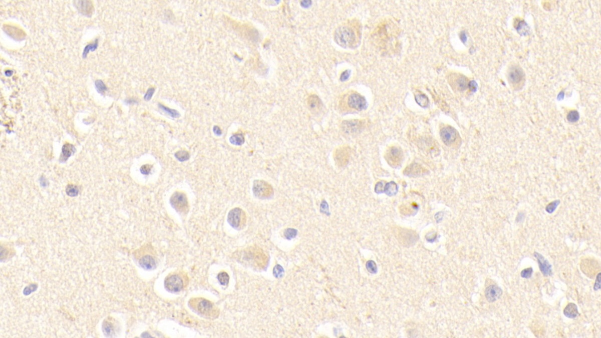 Polyclonal Antibody to Apolipoprotein E (APOE)