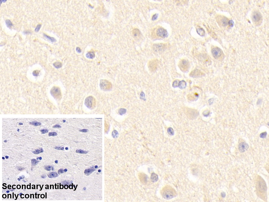 Polyclonal Antibody to Apolipoprotein E (APOE)