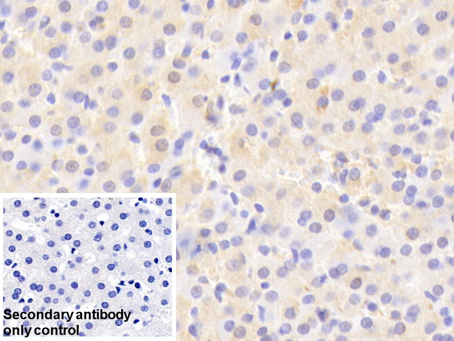 Polyclonal Antibody to Apolipoprotein E (APOE)