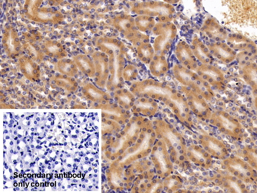 Polyclonal Antibody to Apolipoprotein E (APOE)