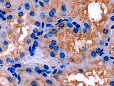 Polyclonal Antibody to Apolipoprotein E (APOE)