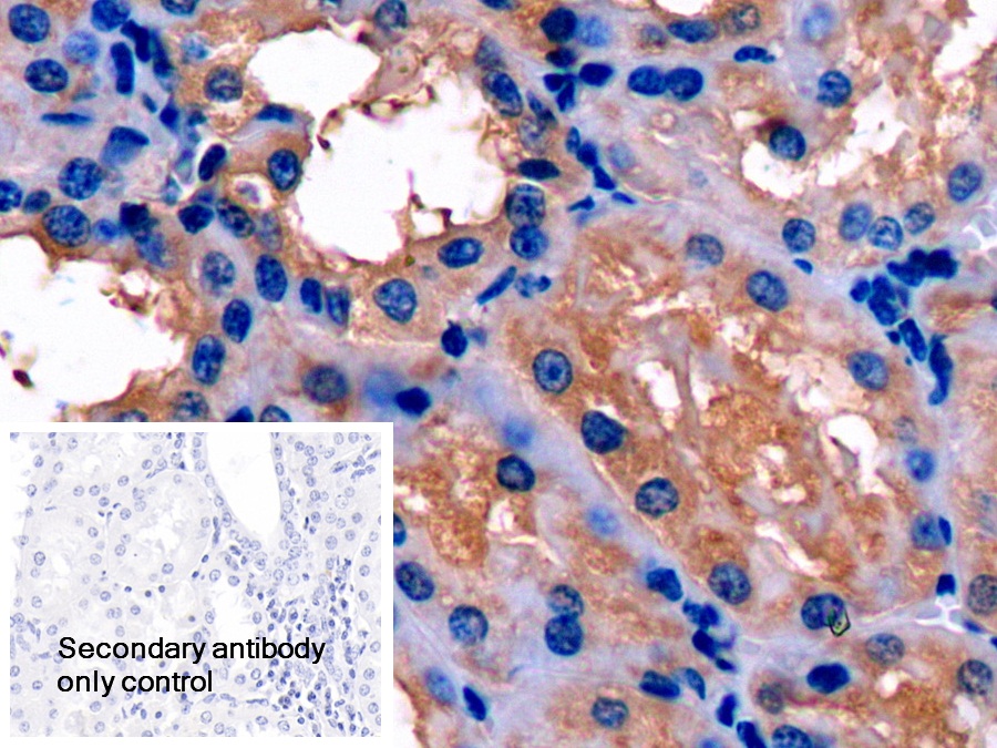 Polyclonal Antibody to Apolipoprotein E (APOE)