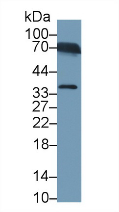 Polyclonal Antibody to Apolipoprotein E (APOE)