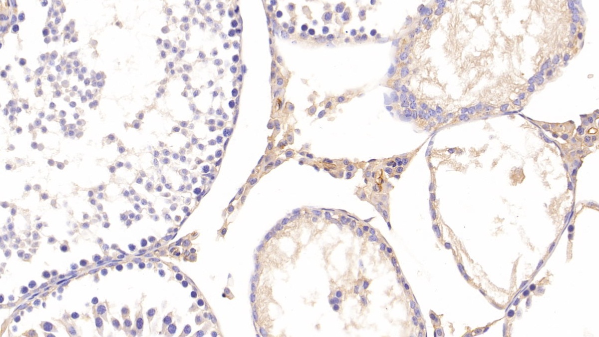 Polyclonal Antibody to Apolipoprotein E (APOE)