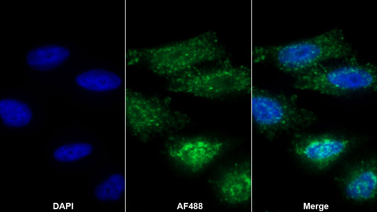 Polyclonal Antibody to Mucin 2 (MUC2)