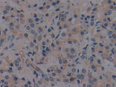 Polyclonal Antibody to Toll Like Receptor 9 (TLR9)