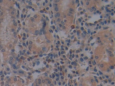 Polyclonal Antibody to Toll Like Receptor 9 (TLR9)