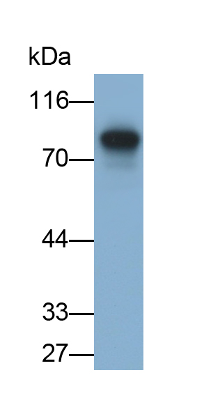 Polyclonal Antibody to Prothrombin Fragment 1+2 (F1+2)
