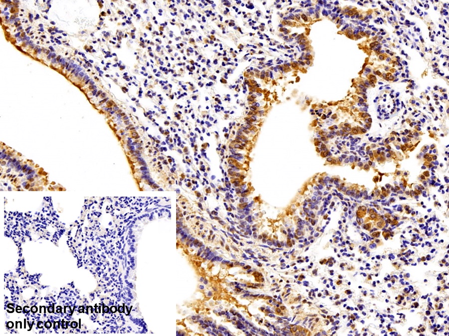 Polyclonal Antibody to Heparanase (HPSE)