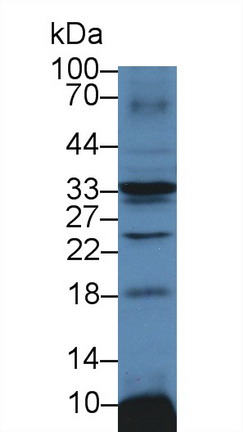 Polyclonal Antibody to Sodium/potassium Transporting ATPase Subunit Beta-3 (ATP1b3)