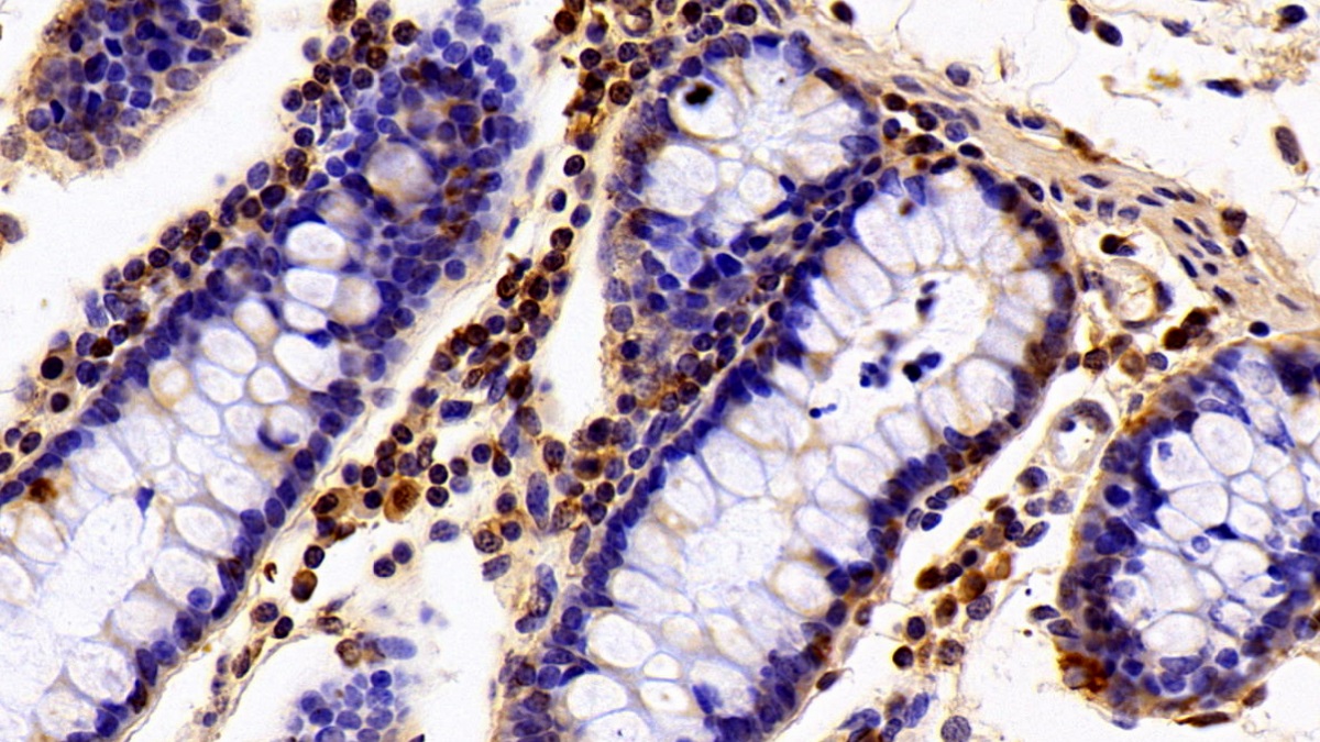 Polyclonal Antibody to Hypoxanthine Phosphoribosyltransferase 1 (HPRT1)