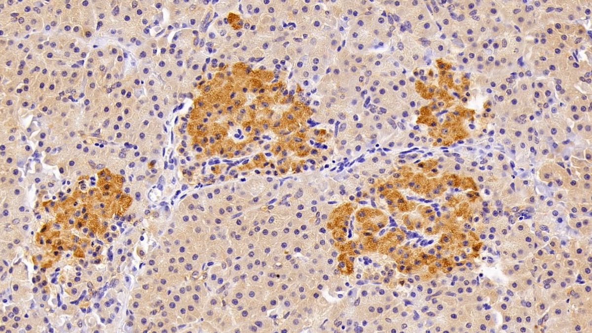 Polyclonal Antibody to Hypoxanthine Phosphoribosyltransferase 1 (HPRT1)