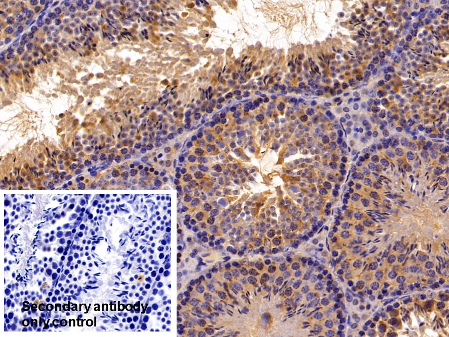 Polyclonal Antibody to Stromal Cell Derived Factor 4 (SDF4)