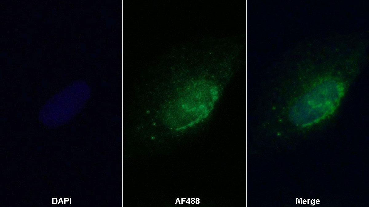 Polyclonal Antibody to Stromal Cell Derived Factor 4 (SDF4)