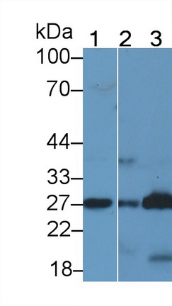 Polyclonal Antibody to Prostaglandin-H2 D-isomerase (PTGDS)