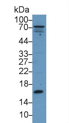 Polyclonal Antibody to Prealbumin (PALB)