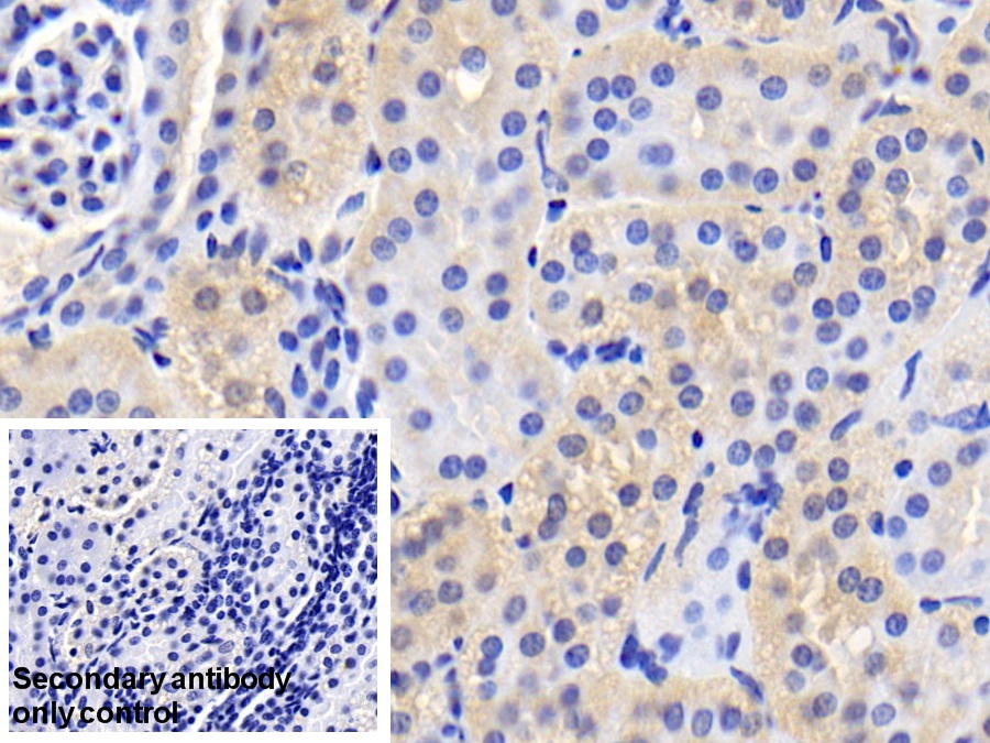 Polyclonal Antibody to Prealbumin (PALB)