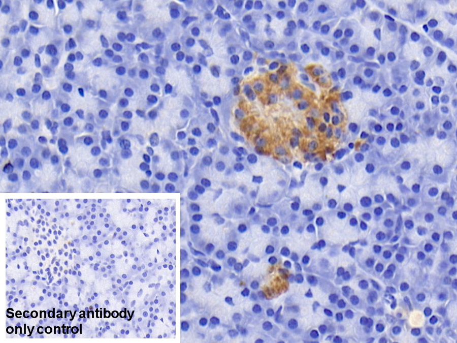 Polyclonal Antibody to Prealbumin (PALB)