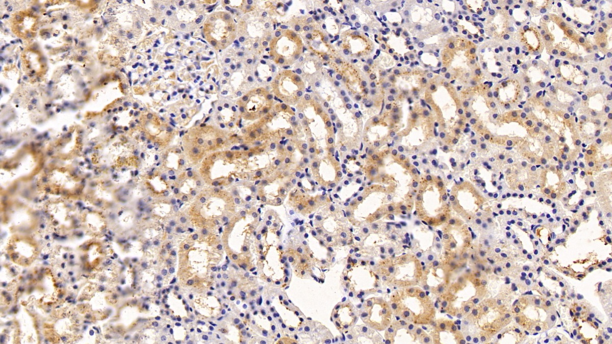 Polyclonal Antibody to Prealbumin (PALB)