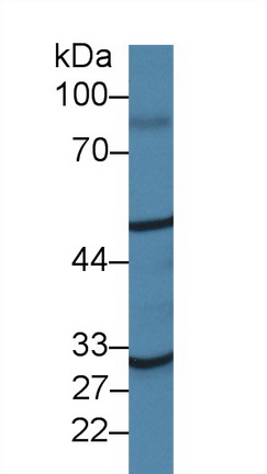 Polyclonal Antibody to Prostaglandin I Synthase (PTGIS)