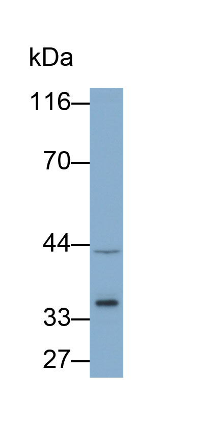 Polyclonal Antibody to Dickkopf Related Protein 1 (DKK1)