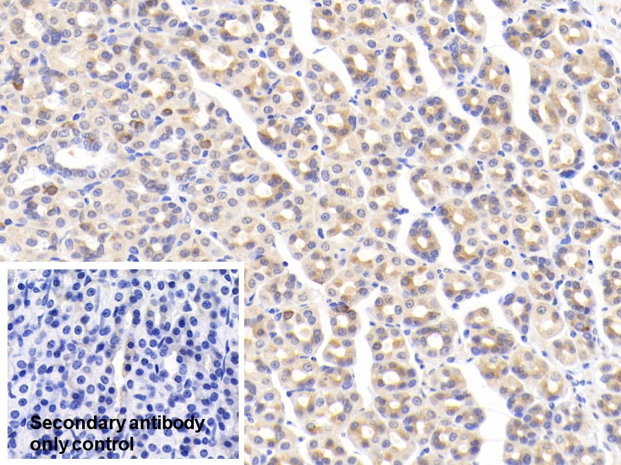 Polyclonal Antibody to Trefoil Factor 2 (TFF2)