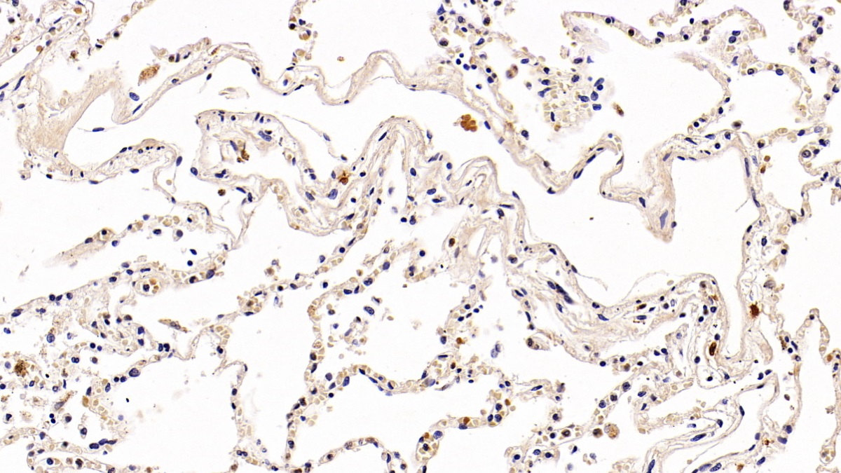 Polyclonal Antibody to Programmed Cell Death Protein 1 (PD1)