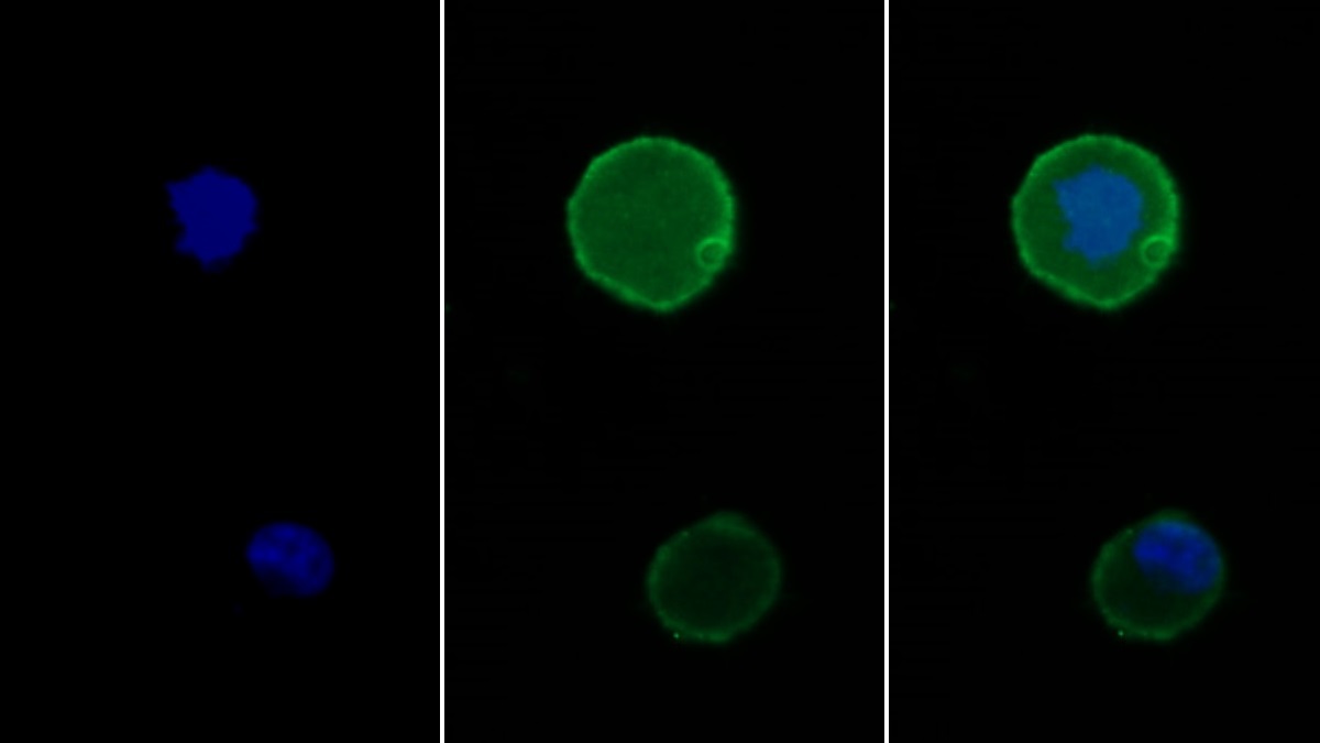 Polyclonal Antibody to Programmed Cell Death Protein 1 (PD1)