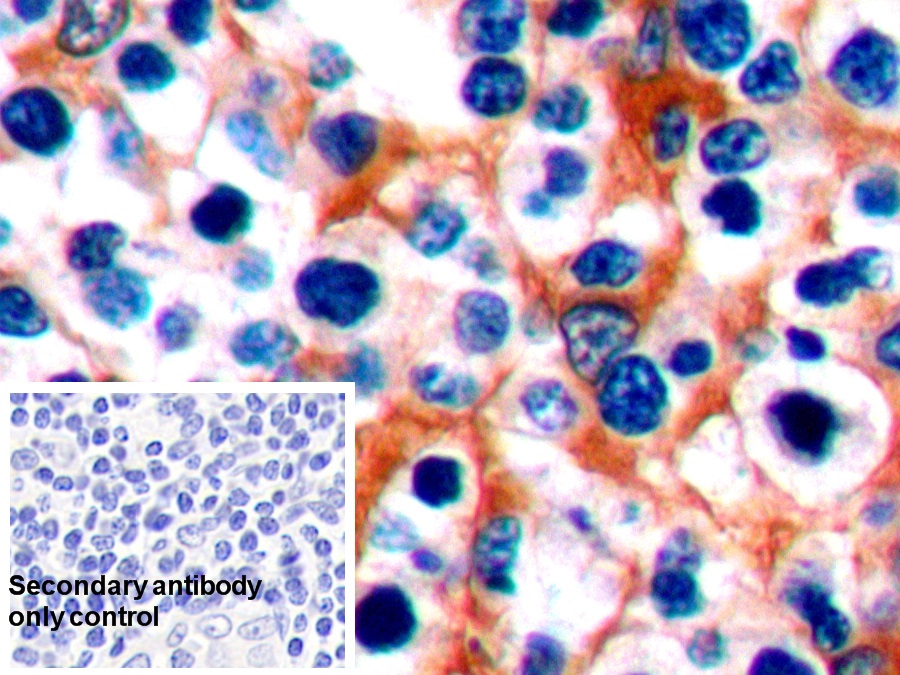 Polyclonal Antibody to Programmed Cell Death Protein 1 (PD1)