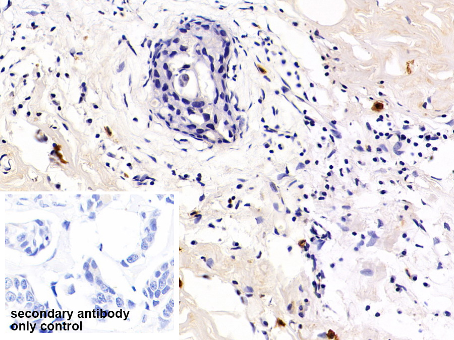 Polyclonal Antibody to Programmed Cell Death Protein 1 (PD1)