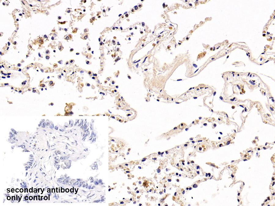 Polyclonal Antibody to Programmed Cell Death Protein 1 (PD1)