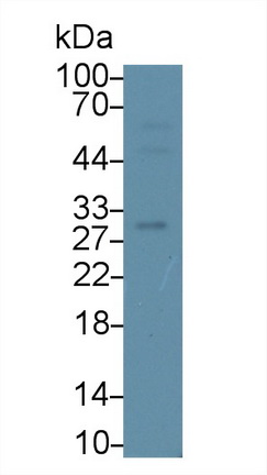 Polyclonal Antibody to Cluster Of Differentiation 38 (CD38)