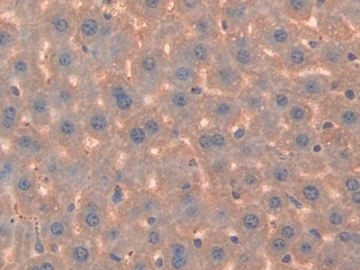 Polyclonal Antibody to Cluster Of Differentiation 38 (CD38)