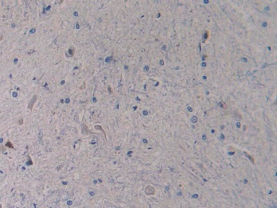 Polyclonal Antibody to Toll Like Receptor 4 (TLR4)