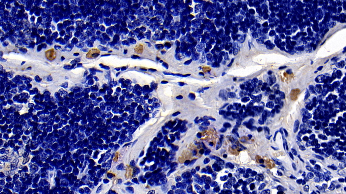 Polyclonal Antibody to Toll Like Receptor 4 (TLR4)