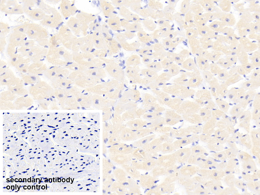 Polyclonal Antibody to Myosin Heavy Chain 1 (MYH1)