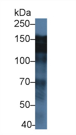 Polyclonal Antibody to Epidermal Growth Factor Receptor (EGFR)