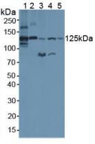 Polyclonal Antibody to Complement C3 Convertase (C3 Convertase)