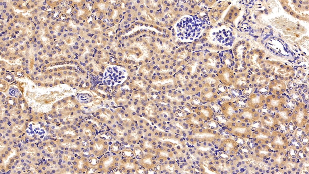 Polyclonal Antibody to Complement C3 Convertase (C3 Convertase)