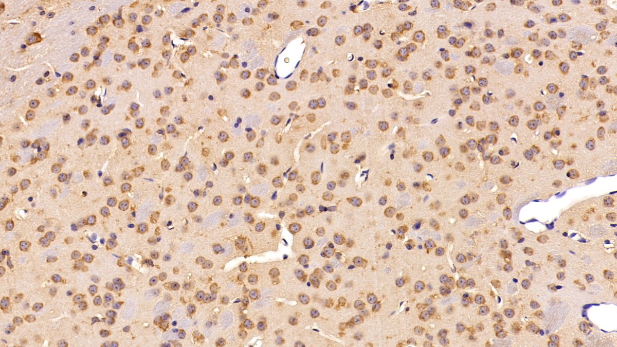 Polyclonal Antibody to Complement C3 Convertase (C3 Convertase)