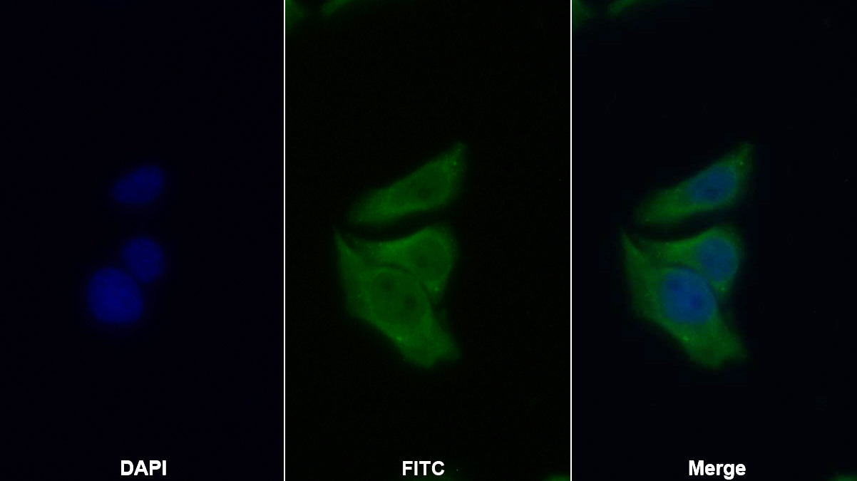 Polyclonal Antibody to Forkhead Box Protein O1 (FOXO1)