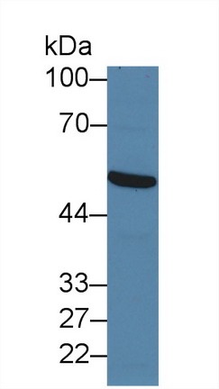 Polyclonal Antibody to Forkhead Box Protein P1 (FOXP1)