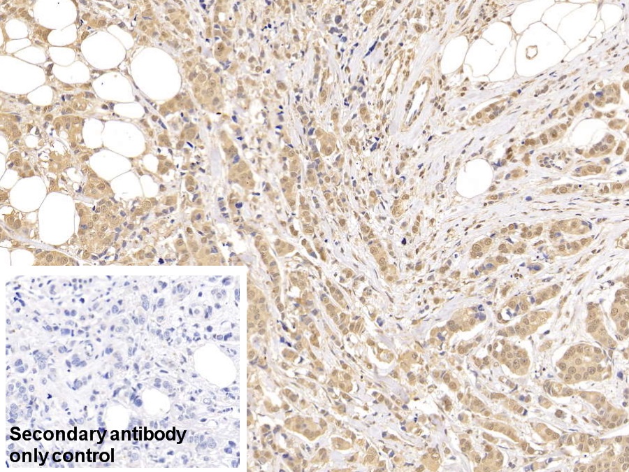 Polyclonal Antibody to Forkhead Box Protein P1 (FOXP1)