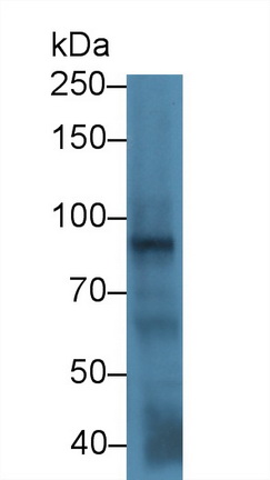 Polyclonal Antibody to Forkhead Box Protein P1 (FOXP1)